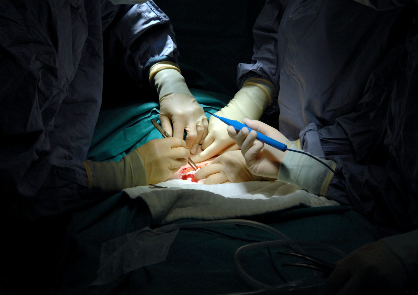 Normal-vs.-Caesarean-Section