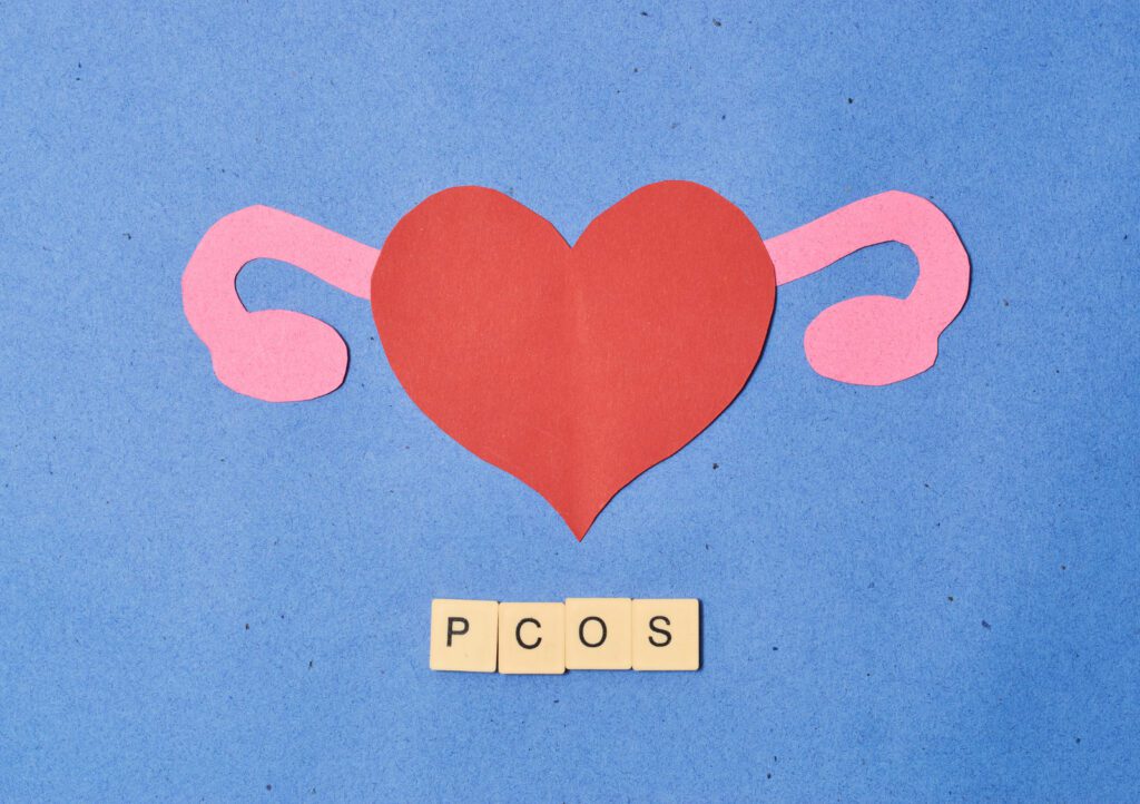 PCOS