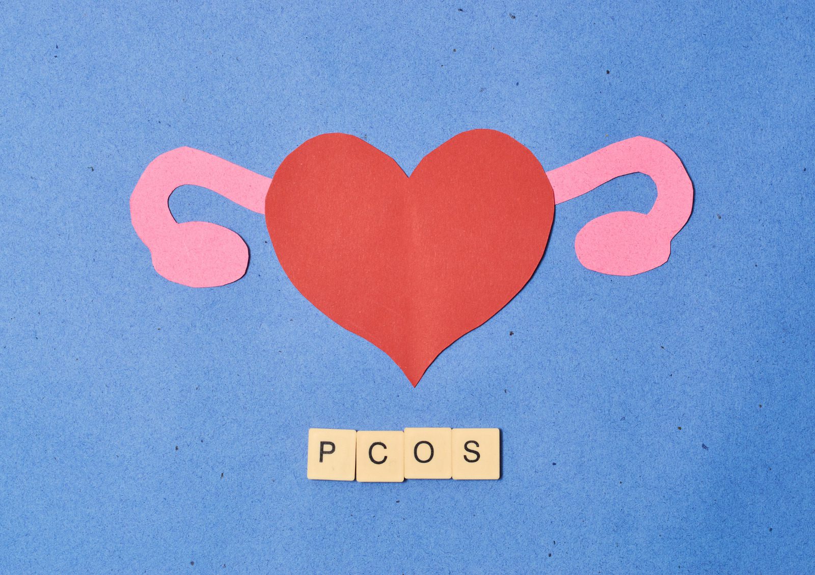 PCOS