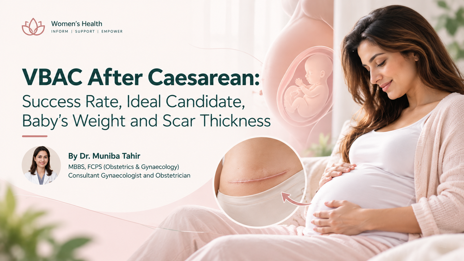 VBAC After Caesarean Success Guide